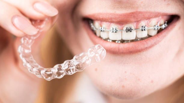 How Smyrna Orthodontics Can Improve Your Smile and Oral Health